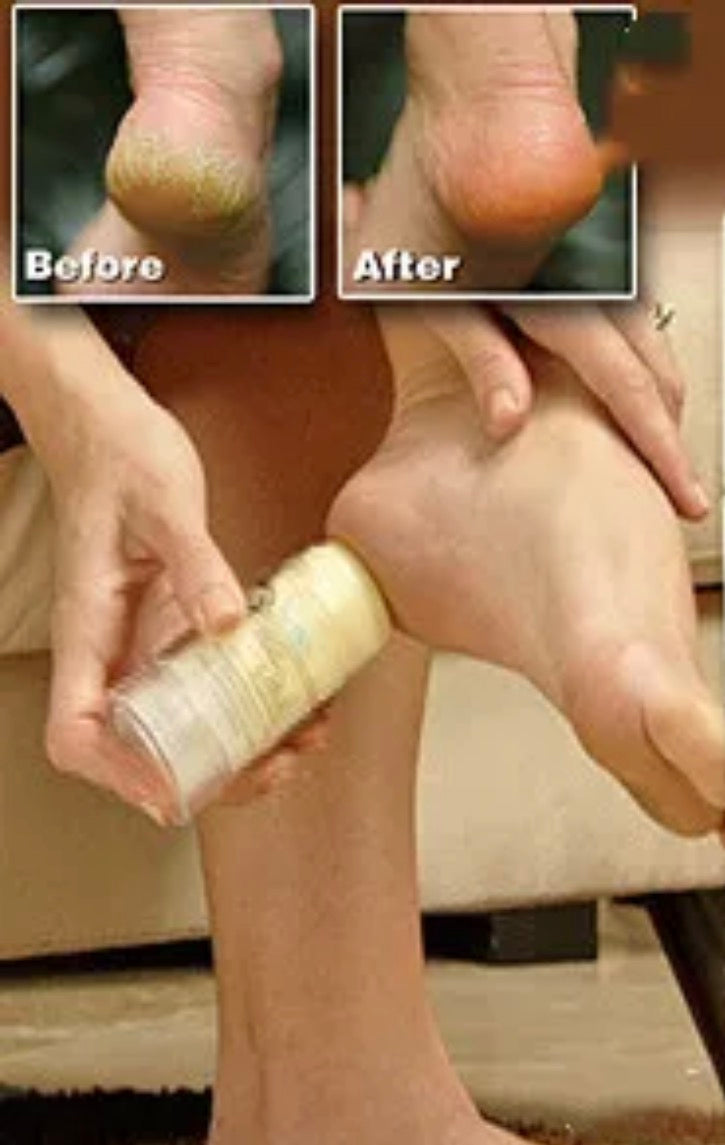 Fashionable and effective foot balm Moisturizing Cream Stick (highly recommended)